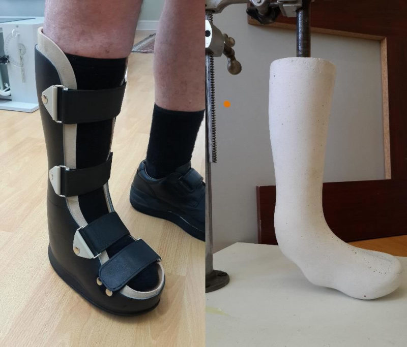 Orthotics Ability Prosthetics and Orthotics