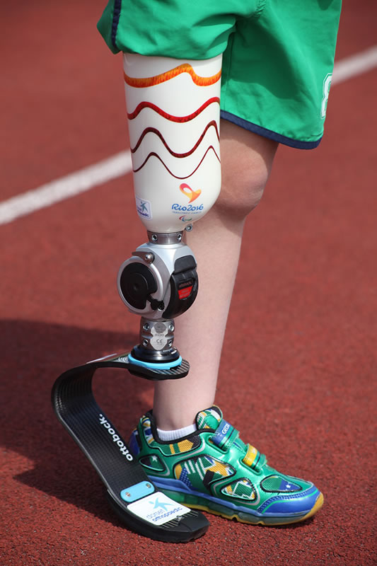 Kids prosthetics