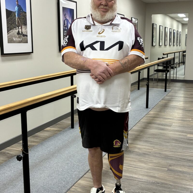 Broncos Prosthesis